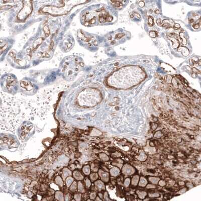 Immunohistochemistry-Paraffin: MCAM/CD146 Antibody (CL12855) [NBP3-18546]