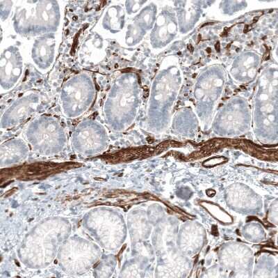 Immunohistochemistry-Paraffin: MCAM/CD146 Antibody (CL12855) [NBP3-18546]