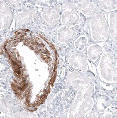 Immunohistochemistry-Paraffin: MCAM/CD146 Antibody (CL12855) [NBP3-18546]