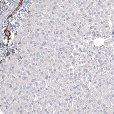 Immunohistochemistry-Paraffin: MCAM/CD146 Antibody (CL12855) [NBP3-18546]