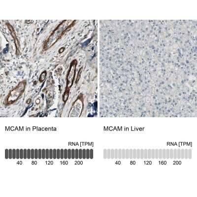 Immunohistochemistry-Paraffin: MCAM/CD146 Antibody [NBP1-88132]