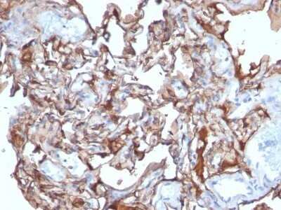 Immunohistochemistry-Paraffin: MCAM/CD146 Antibody (MCAM/1101) - Azide and BSA Free [NBP2-47776]