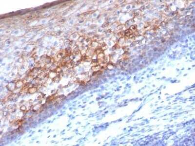 Immunohistochemistry-Paraffin: MCAM/CD146 Antibody (MCAM/1101) - Azide and BSA Free [NBP2-47776]
