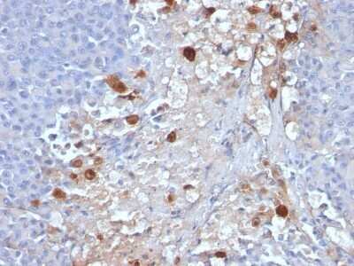 Immunohistochemistry-Paraffin: MCAM/CD146 Antibody (MCAM/1101) [NBP2-44509]
