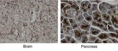 Immunohistochemistry-Paraffin: MCAM/CD146 Antibody (MUC18/1130) - Azide and BSA Free [NBP2-47777]