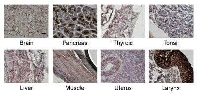 Immunohistochemistry-Paraffin: MCAM/CD146 Antibody (MUC18/1130) - Azide and BSA Free [NBP2-47777]