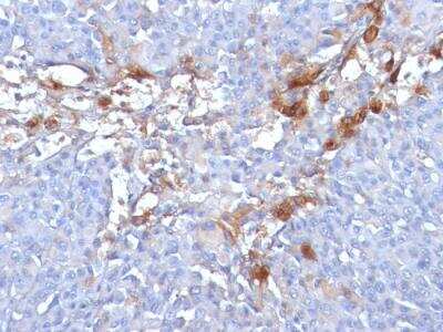 Immunohistochemistry-Paraffin: MCAM/CD146 Antibody (MUC18/1130) - IHC-Prediluted [NBP2-48207]