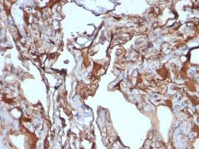 Immunohistochemistry-Paraffin: MCAM/CD146 Antibody (MUC18/1130) [NBP2-44512]