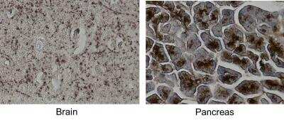Immunohistochemistry-Paraffin: MCAM/CD146 Antibody (MUC18/1130) [NBP2-44512]