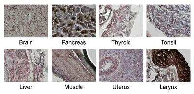 Immunohistochemistry-Paraffin: MCAM/CD146 Antibody (MUC18/1130) [NBP2-44512]