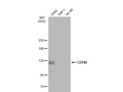 Western Blot: MCAM/CD146 Antibody [NBP2-15778]