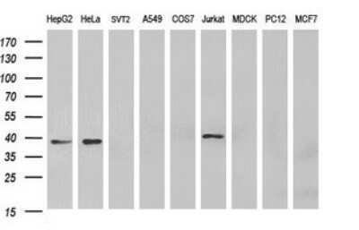 Western Blot: MCAT Antibody (OTI2B7) [NBP2-45771]