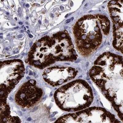 Immunohistochemistry-Paraffin: MCCC2 Antibody [NBP2-38930]