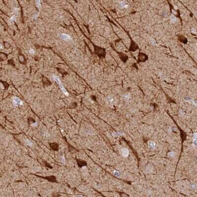 Immunohistochemistry: MCCD1 Antibody [NBP2-47382]