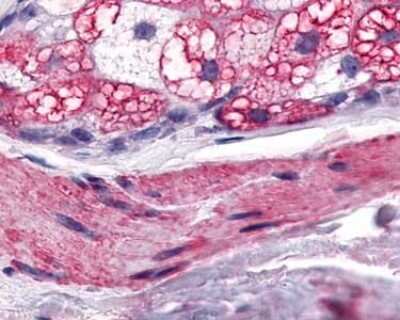 Immunohistochemistry-Paraffin: MCHR1 Antibody - BSA Free [NLS1533]