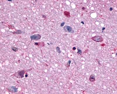 Immunohistochemistry-Paraffin: MCHR1 Antibody - BSA Free [NLS1533]