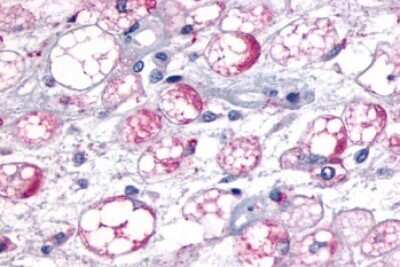 Immunohistochemistry-Paraffin: MCHR1 Antibody - BSA Free [NLS1533]