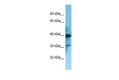 Western Blot: MCHR2 Antibody [NBP2-82281]