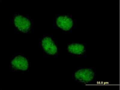Immunocytochemistry/ Immunofluorescence: MCM10 Antibody [H00055388-B01P]