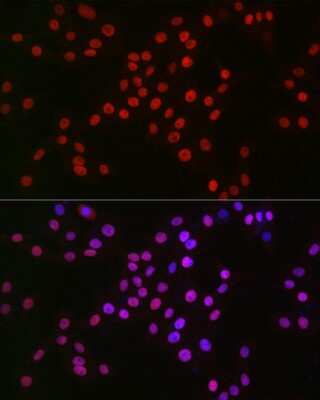Immunocytochemistry/ Immunofluorescence: MCM2 Antibody (0Q10S9) [NBP3-16066]