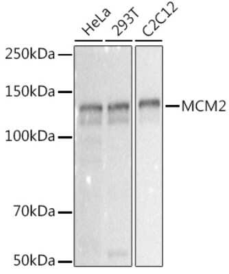 Western Blot: MCM2 Antibody (0Q10S9) [NBP3-16066]