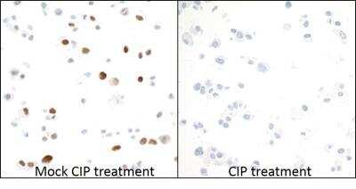 Immunocytochemistry: MCM2 Antibody (BLR108H) [NBP3-07021]
