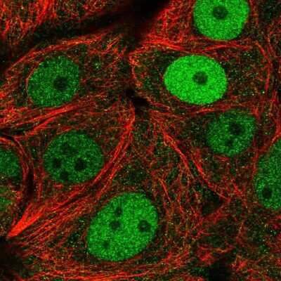Immunocytochemistry/ Immunofluorescence: MCM2 Antibody [NBP2-33954]