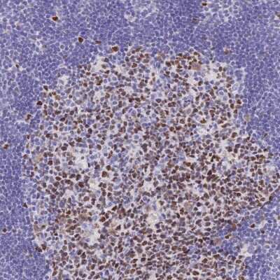 Immunohistochemistry-Paraffin: MCM2 Antibody [NBP2-33954]
