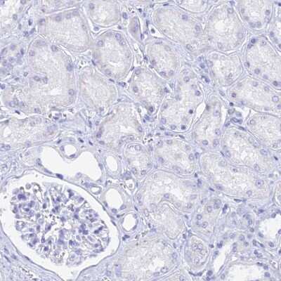 Immunohistochemistry-Paraffin: MCM2 Antibody [NBP2-33954]