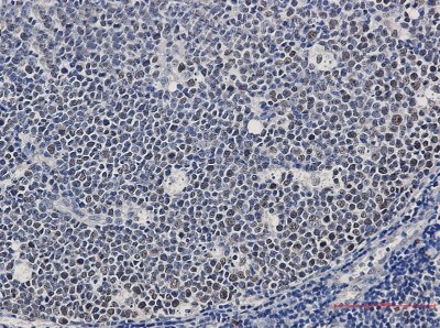 Immunohistochemistry-Paraffin: MCM2 Antibody (S02-0D3) [NBP3-19887]