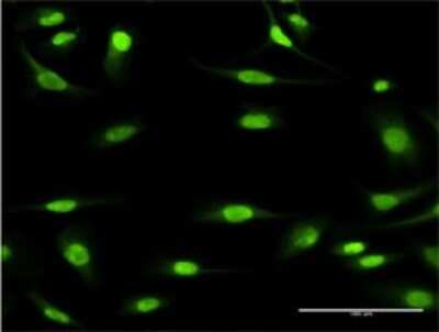Immunocytochemistry/ Immunofluorescence: MCM3 Antibody (2H3) [H00004172-M04]