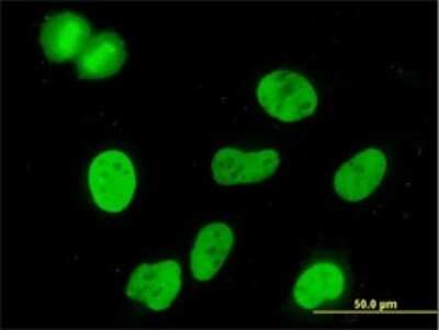 Immunocytochemistry/ Immunofluorescence: MCM3 Antibody (3E1) [H00004172-M03]