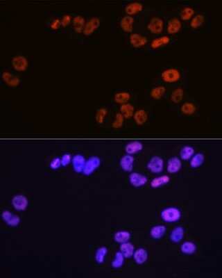 Immunocytochemistry/ Immunofluorescence: MCM3 Antibody (9Z5W4) [NBP3-15386]