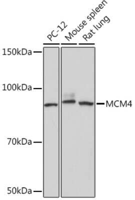 Western Blot: MCM4 Antibody (5N0X3) [NBP3-16791]