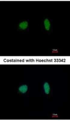 Immunocytochemistry/ Immunofluorescence: MCM4 Antibody [NBP1-33105]
