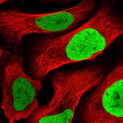 Immunocytochemistry/ Immunofluorescence: MCM4 Antibody [NBP2-58370]