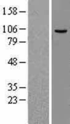 Western Blot: MCM4 Overexpression Lysate [NBL1-12953]