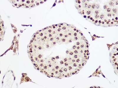 Immunohistochemistry-Paraffin: MCM5 Antibody (4P1Q5) [NBP3-16529]