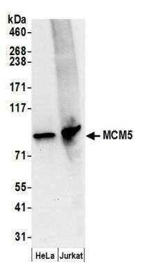 Western Blot: MCM5 Antibody [NB100-79778]