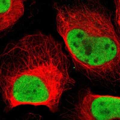 Immunocytochemistry/ Immunofluorescence: MCM6 Antibody [NBP1-82642]