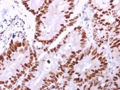 Immunohistochemistry-Paraffin: MCM6 Antibody (MCM6/2999) - Azide and BSA Free [NBP2-79862]