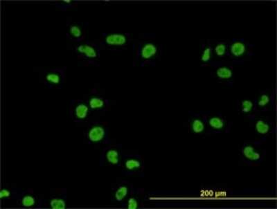 Immunocytochemistry/ Immunofluorescence: MCM7 Antibody (6C2) [H00004176-M01]