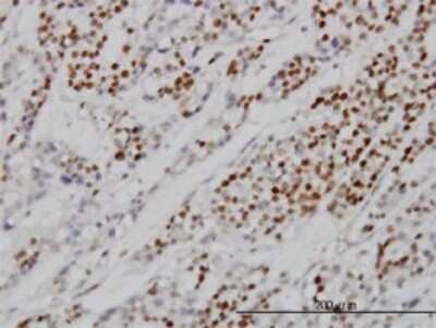 Immunohistochemistry-Paraffin: MCM7 Antibody (6C2) [H00004176-M01]