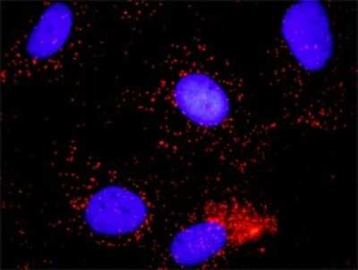 Proximity Ligation Assay: MCM7 Antibody (6C2) [H00004176-M01]