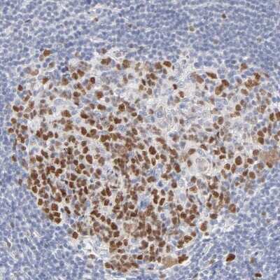 Immunohistochemistry-Paraffin: MCM7 Antibody [NBP1-85721]