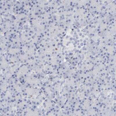 Immunohistochemistry-Paraffin: MCM7 Antibody [NBP1-85721]