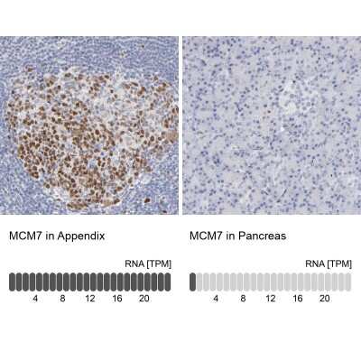Immunohistochemistry-Paraffin: MCM7 Antibody [NBP1-85721]