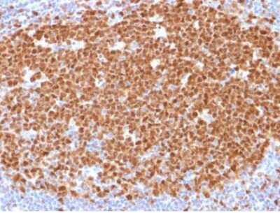 Immunohistochemistry-Paraffin: MCM7 Antibody (MCM7/1468) [NBP2-59610]