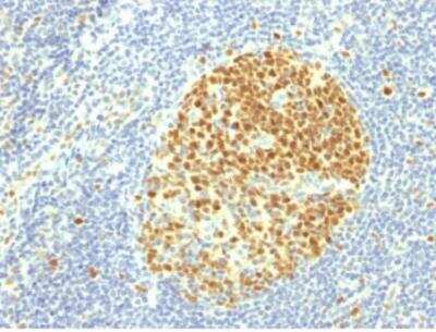 Immunohistochemistry-Paraffin: MCM7 Antibody (MCM7/1469) [NBP2-59613]