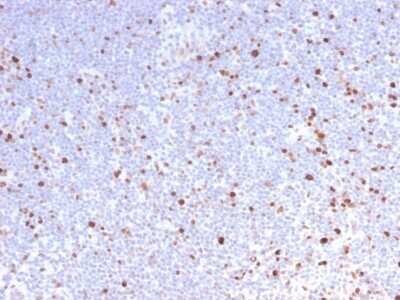 Immunohistochemistry-Paraffin: MCM7 Antibody (MCM7/2832R) - Azide and BSA Free [NBP3-08405]